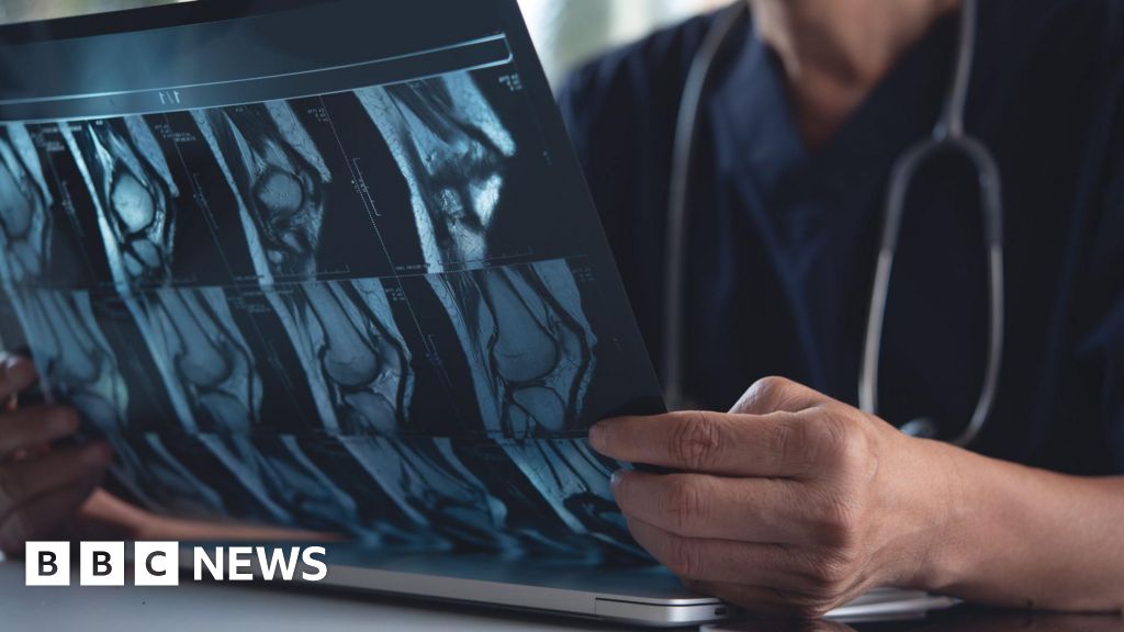 ai-breakthrough-in-predicting-osteoarthritis-progression-unveiled-by-surrey-researchers