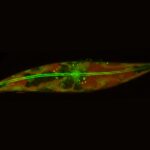 arctic-diatoms-defy-biological-norms-raising-climate-concerns