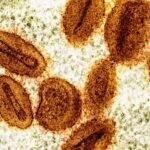 australia-s-mpox-cases-plummet-in-2025-a-public-health-success-story