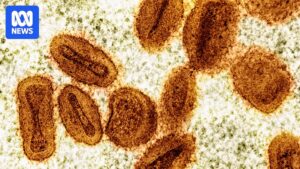 australia-s-mpox-cases-plummet-in-2025-a-public-health-success-story
