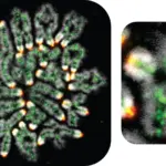 breakthrough-in-dna-research-links-miscarriages-and-infertility-to-chromosome-errors