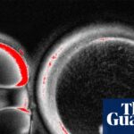 breakthrough-in-fertility-human-skin-cells-transformed-into-eggs