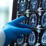 breakthrough-mri-scans-could-revolutionize-dementia-diagnosis