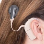 cochlear-implants-sound-quality-s-impact-on-quality-of-life
