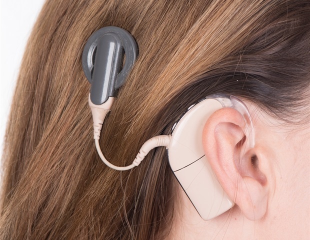 cochlear-implants-sound-quality-s-impact-on-quality-of-life