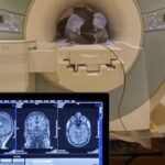 innovative-40hz-sensory-stimulation-shows-promise-for-alzheimer-s-patients