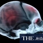 shaken-baby-syndrome-are-innocent-families-paying-the-price-