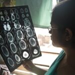 who-calls-for-urgent-global-action-on-neurological-disorders