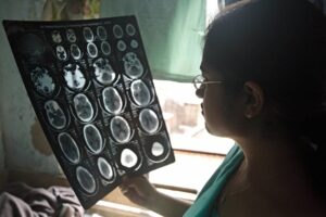 who-calls-for-urgent-global-action-on-neurological-disorders