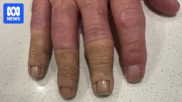 australian-prosthetics-clients-seek-compensation-amid-investigation