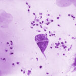 innovative-dna-test-revolutionizes-tracking-of-leishmaniasis