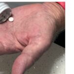 long-term-melatonin-use-linked-to-increased-heart-risks-new-study-finds