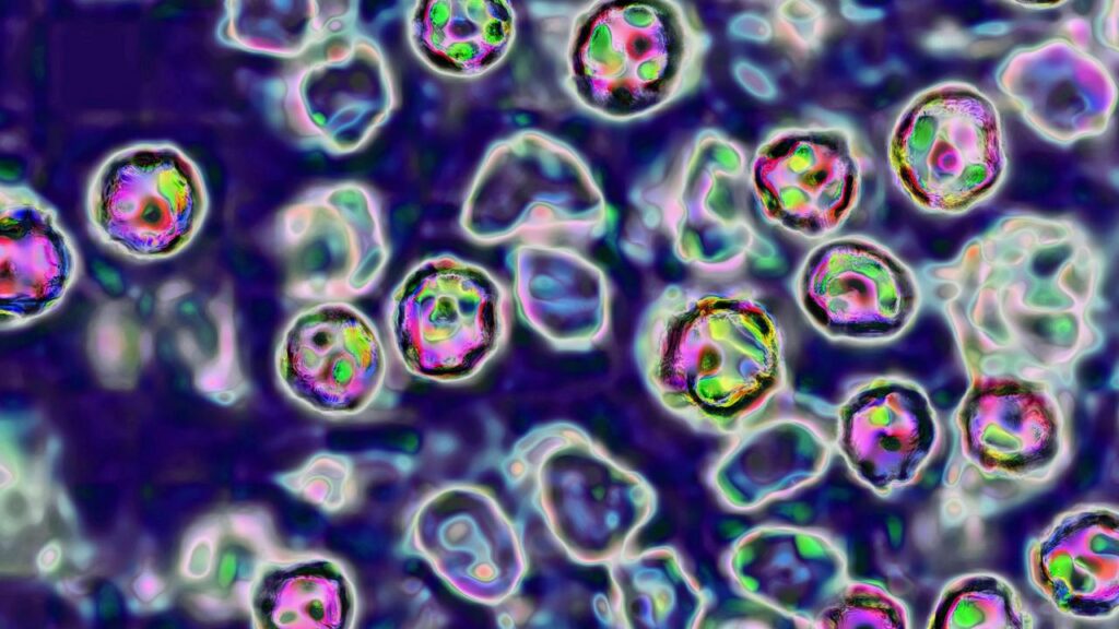 measles-alert-in-sydney-unknown-source-sparks-health-concerns