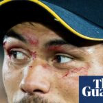 rugby-s-hidden-battle-shane-christie-s-legacy-in-the-fight-against-cte