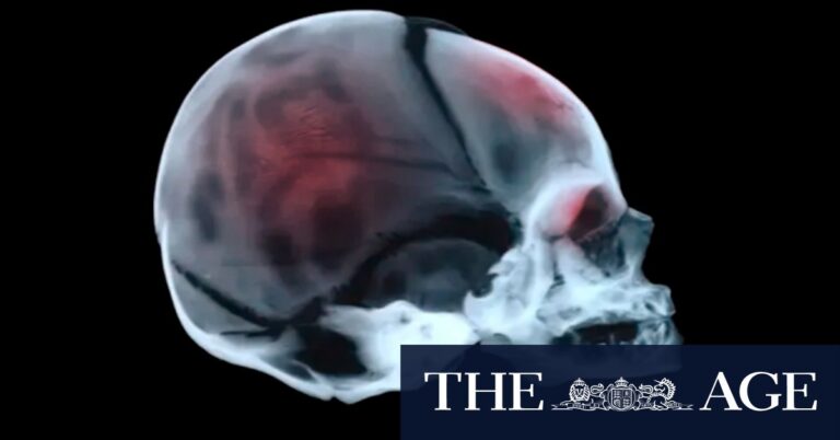 shaken-baby-syndrome-are-innocent-families-being-wrongly-convicted-