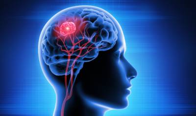 14-million-brain-tumour-research-consortium-aims-to-transform-treatment