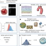 genetic-insights-and-ai-revolutionize-aortic-stenosis-diagnosis