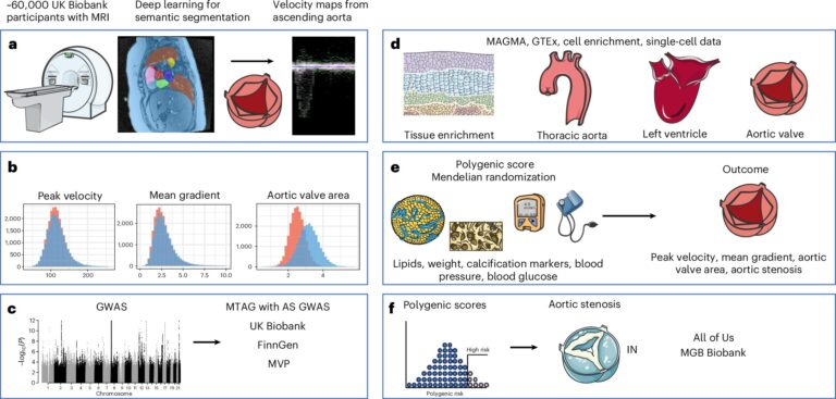 genetic-insights-and-ai-revolutionize-aortic-stenosis-diagnosis