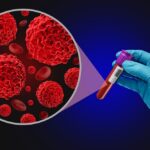 Blood Cancer Screening