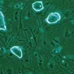 mammalian-pregnancy-pause-mechanism-offers-new-insights-for-cancer-research