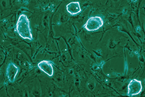 mammalian-pregnancy-pause-mechanism-offers-new-insights-for-cancer-research