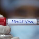 new-mpox-strain-detected-in-england-sparks-health-concerns
