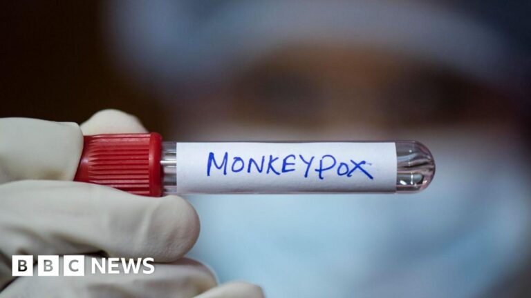 new-mpox-strain-detected-in-england-sparks-health-concerns