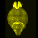 new-study-reveals-daily-changes-in-brain-activity-implications-for-fatigue-and-mental-health