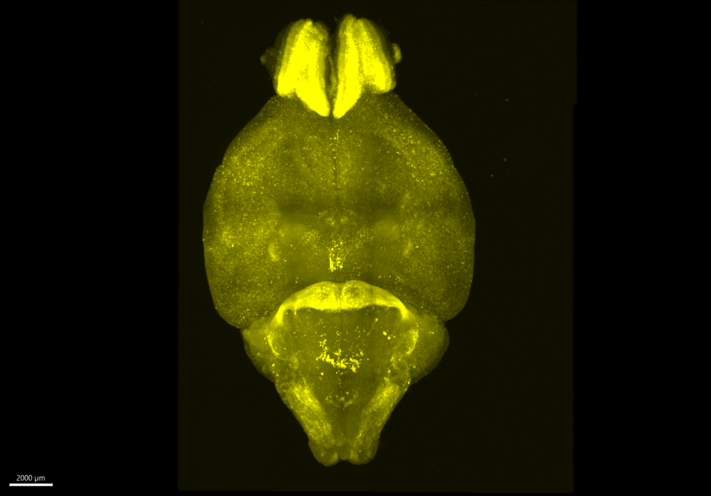 new-study-reveals-daily-changes-in-brain-activity-implications-for-fatigue-and-mental-health
