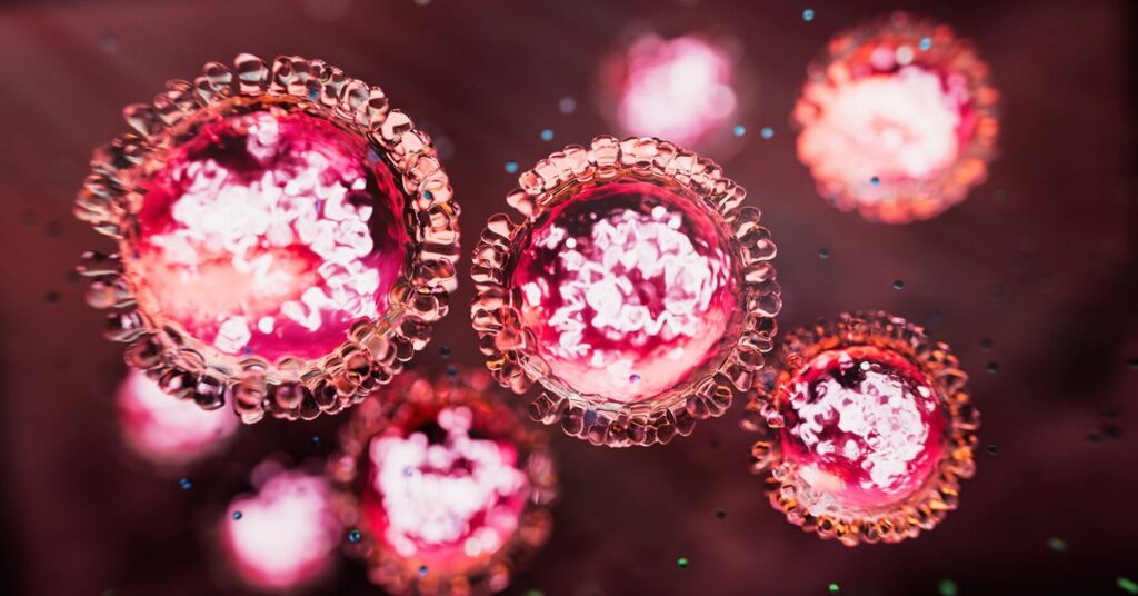 sydney-residents-alerted-to-measles-risk-after-confirmed-case