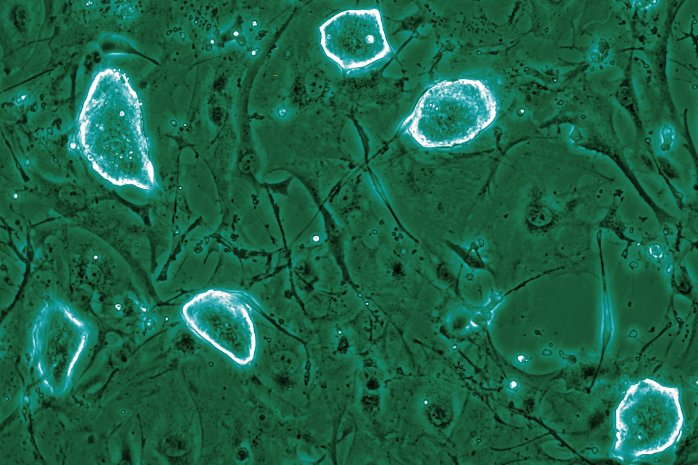 understanding-embryonic-diapause-new-insights-for-cancer-research