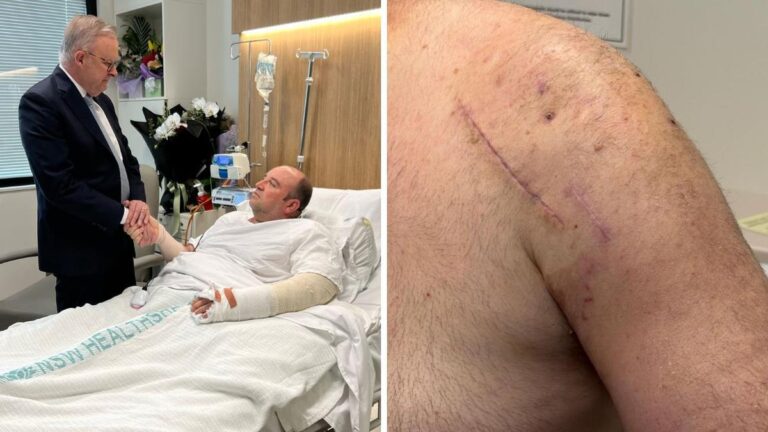 bondi-hero-faces-uncertain-future-after-life-saving-actions