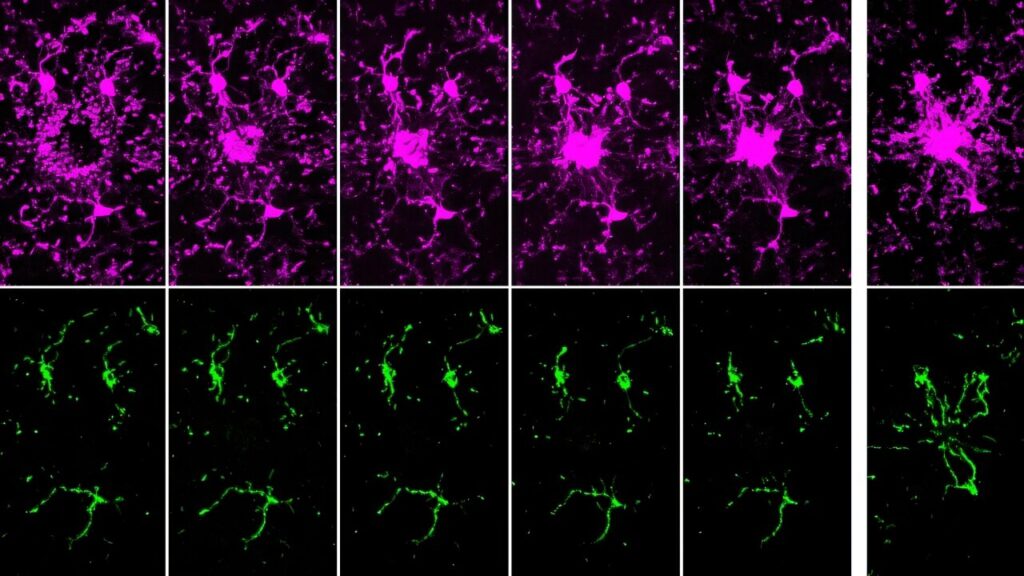 brain-s-immune-cells-use-sugar-surge-to-power-initial-defense