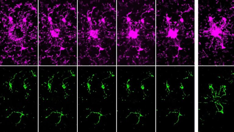brain-s-immune-cells-use-sugar-surge-to-power-initial-defense