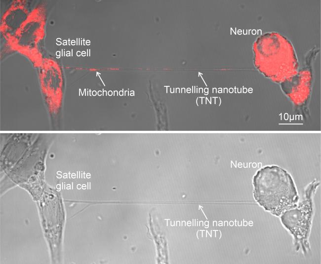 breakthrough-in-mitochondrial-transfer-offers-hope-for-neuropathy-treatment