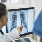 Close up of doctors analysing radiological chest x-ray film