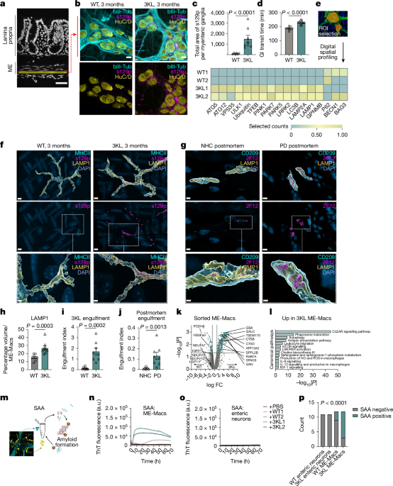 intestinal-macrophages-influence-brain-disorders-new-research-reveals-gut-brain-connection