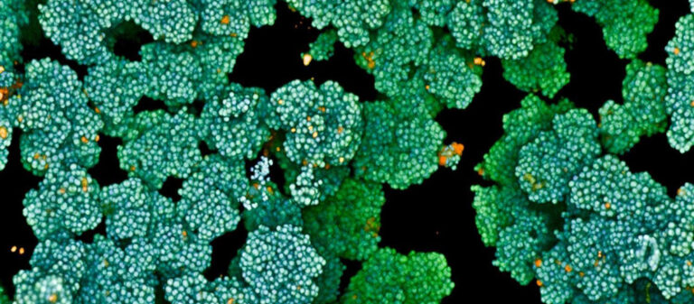 breakthrough-in-combating-bacterium-hindering-wound-healing