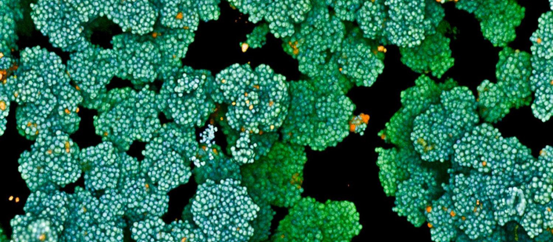 breakthrough-in-combating-bacterium-hindering-wound-healing