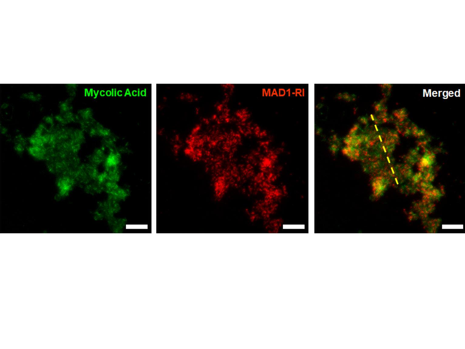 innovative-mini-proteins-could-revolutionize-tuberculosis-treatment