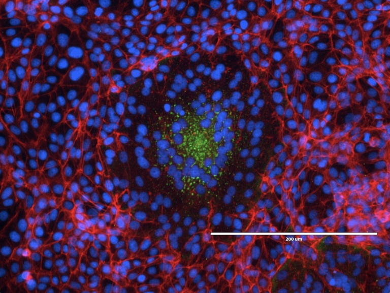nipah-virus-outbreak-australian-researchers-lead-global-response