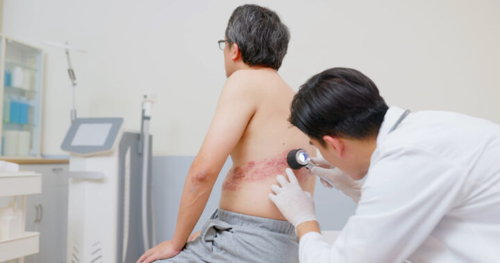 australians-encouraged-to-discuss-shingles-risks-with-healthcare-providers
