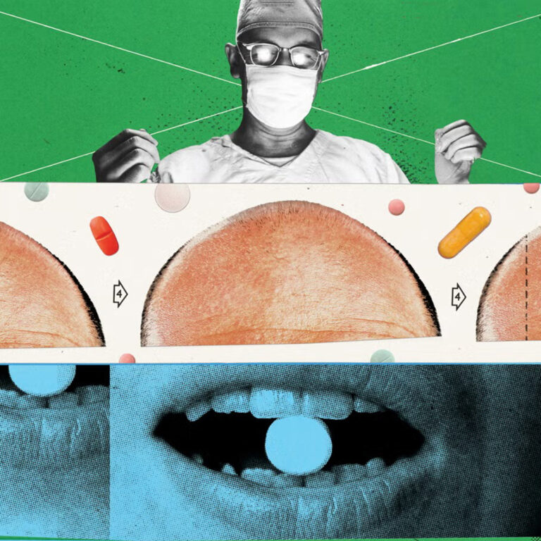 breakthrough-hair-loss-treatment-offers-new-hope-for-balding-men