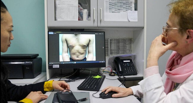 chile-achieves-historic-milestone-in-leprosy-elimination